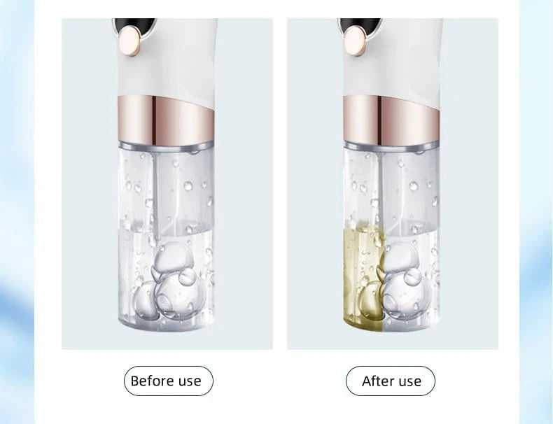 Hydra Facial Blackhead & Whitehead Remover